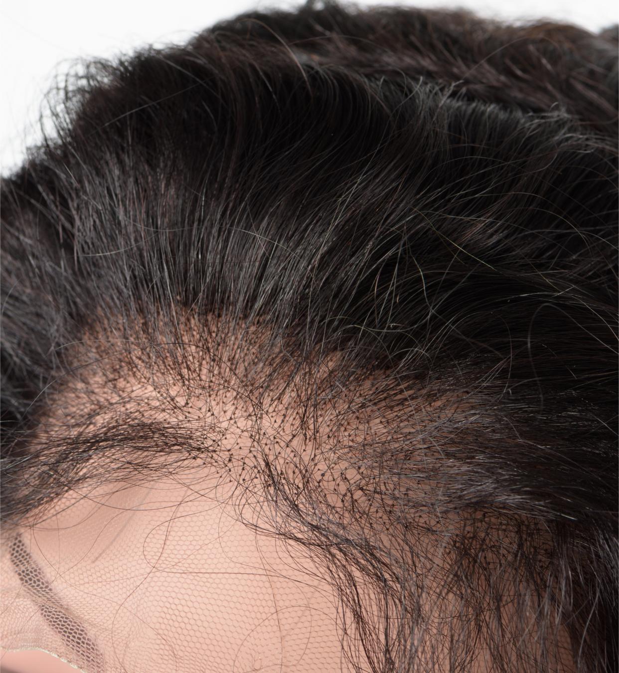 4 Reasons Why Your Lace Closure or Lace Frontal is Balding Schwan Hair